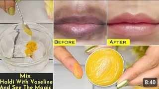 pigmented lips treatment  7day challenge to change lip color  dark lips treatment [upl. by Sixela]