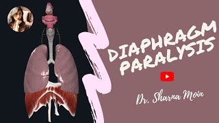 Diaphragm paralysis paradoxical breathing  injury to phrenic nerve [upl. by Garvey]