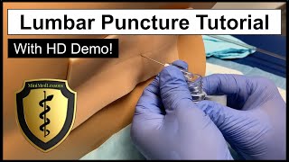 Lumbar Puncture Spinal Tap  Comprehensive Tutorial amp Demonstration [upl. by Antoni407]