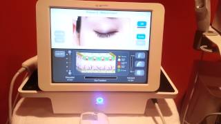 2010 Syneron eMatrix eTwo Sublative Radio Frequency Rejuvenation and Wrinkle Treatment For Sale [upl. by Else]