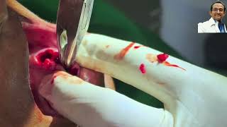 step by step demonstration of extraction of a tooth by dr nishit kumar mds [upl. by Wymore682]