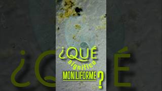 ¿Qué significa quotmoniliformequot Stentor coeruleus Ciliophora [upl. by Dwane]