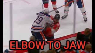 Barkov Leaves Game After Hit From Draisaitl [upl. by Raama206]