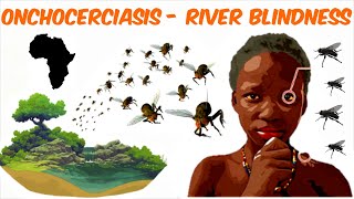 Onchocerciasis  River Blindness [upl. by Ianahs]