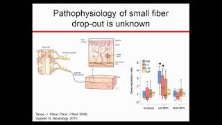 Small Fiber Neuropathy and ARA290 Results [upl. by Adela]