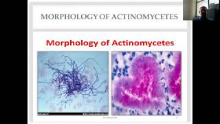 Actinomycetes and Nocardia Diverse Group of Gram Positive Bacilli [upl. by Yggep]