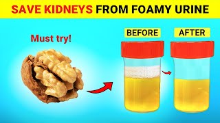 Top 6 Super Foods To Help Stop Proteinuria and Heal Your Kidneys [upl. by Gerrald]