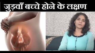 जुड़वाँ बच्चे होने का आसान तरीका  Twins Pregnancy and Symptoms [upl. by Lati]