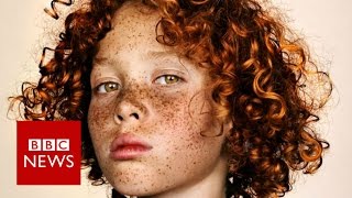 Celebrating freckles in all their glory  BBC News [upl. by Irrahs67]