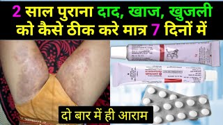 2 साल पुराने दाद खाज खुजली को कैसे ठीक करें  fungal infection in private parts  khujli ki dawa [upl. by Anilah]