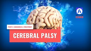 Cerebral Palsy Diagnosis and Treatment [upl. by Groves749]