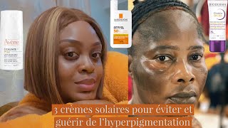 3 crèmes solaire pour éviter et guérir de l’hyperpigmentation  comment protéger sa peau des mbatas [upl. by Annoyed807]