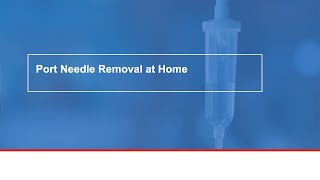 Port Needle Removal at Home [upl. by Enailil]