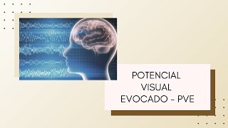 Potencial Visual Evocado  PVE  Dr Emmerson Badaró  Viver oftalmologia [upl. by Hanley16]