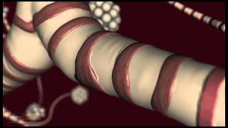 Isocyanate Exposure [upl. by Shirlene]