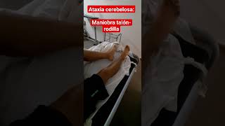 Ataxia Maniobra Talón Rodilla síndrome cerebeloso Mielonisis Funicular déficit B12 [upl. by Kciredor]