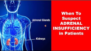 When To Suspect ADRENAL INSUFFICIENCY in Patients [upl. by Retrop751]