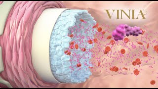 The Science behind how VINIA® works inside your body [upl. by Tillfourd]