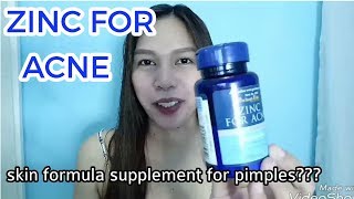 Puritans Pride Zinc For Acne Supplement Review  Effective nga ba Medz ForToday tabletsforacne [upl. by Christan]