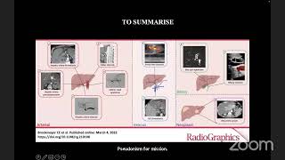 IR Hepatobiliary Imaging Masterclass [upl. by Nedla]