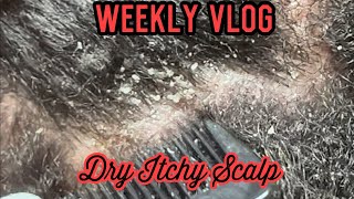 Dry Itchy Scalp  Weekly Vlog contentcreator dandruff itchyscalp subscribe support [upl. by Esau727]