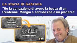 Implantologia Carico Immediato a Pisa la storia di Gabriele [upl. by Olim53]