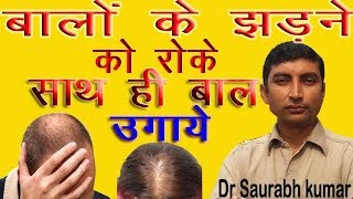 Hair fall  Homeopathic medicine for BALDNESS [upl. by Gitlow]