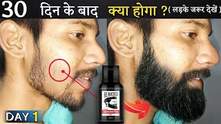 Beardo Hair Growth Oil After 15 Days Review  Best Beard Oil For Patchy Beard in India 2024 [upl. by Howe]