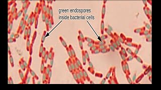 Micro Lab 5 Bacterial Structure Endospores Capsules and Flagella [upl. by Eckardt]