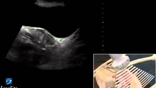 3D Cómo hacer Examen ecográfico de la Pelvis en Mujer  Ultrasonido SonoSite [upl. by Nnaes]