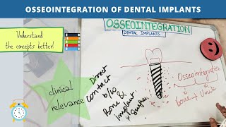 osseointegration of dental implants Part  1 [upl. by Anileva723]