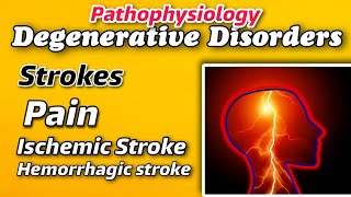 Pathophysiology of DEGENERATIVE DISORDERS  Strokes amp its types  Pain  Expalined by Tutor [upl. by Sidnal]