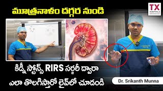 కిడ్నీ స్టోన్స్ RIRS సర్జరీ  RIRS Surgery For Kidney Stone  Kidney Stones Removal  TX Hospitals [upl. by Itteb618]