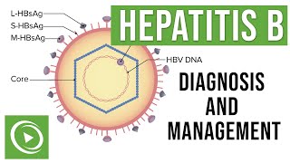 Hepatitis B Overview Clinical Presentation Diagnosis and Management  Lecturio [upl. by Adnamas]