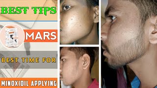 BEARD GROWTH  Best time ⏲️ for minoxidil apply  When is the best time to apply minoxidil [upl. by Alden]