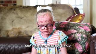 Ellas Epidermolysis Bullosa Story  TagWithElla Campaign [upl. by Kooima]