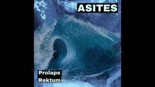 Asites  Prolaps Rektum 2024 [upl. by Osber405]