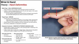 Hand Deformities ✋ How to Identify Them for NPTE ⭐ [upl. by Adnoyek957]