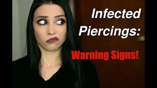 Infected Piercings The Warning Signs amp What To Watch For [upl. by Hitt]