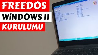 FreeDOS Laptopa Windows 11 Kurma  DETAYLI ANLATIM [upl. by Lou]