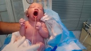 New born baby inhale meconium and amniotic fluid take action remove all by suction clean baby 🖤 [upl. by Jaquiss]