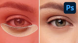 Eliminate Dark Circles and Brighten Eyes in Photoshop [upl. by Lerud486]