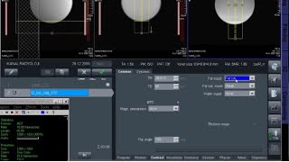 MR  Emar  Teknik Ayarlar 2 Bölüm Fat Sat Nedir Water Sat Nedir Magnetic Resonance Bilgiler [upl. by Norbel]