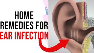 The 3 Effective Home Remedy For Ear Infections [upl. by Diley]