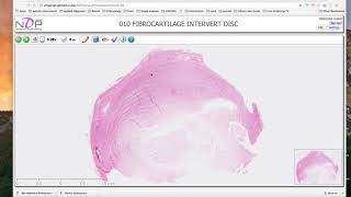 Fibrocartilage histology demonstration [upl. by Pippo]