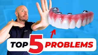 BUYERS BEWARE🚨 Allon4 Dental Implants [upl. by Akalam]