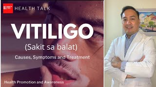 Vitiligo Causes Symptoms and Treatment [upl. by Ruenhs]