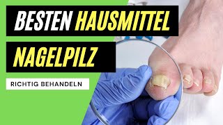 ✅ Nagelpilz behandeln  Die BESTEN Hausmittel zum entfernen [upl. by Klotz36]