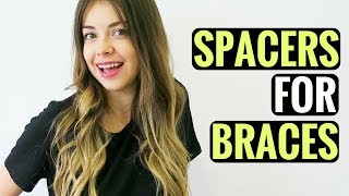 GETTING SPACERS FOR BRACES  WHAT ARE SPACERS PAIN HOW LONG [upl. by Enoryt]