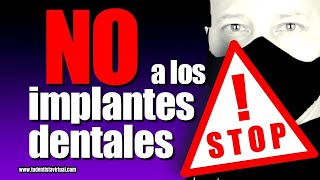 NO CAIGAS EN ESTE ERROR AL REPONER DIENTES CON IMPLANTES DENTALES PUEDES PERDERLO TODO [upl. by Jollanta206]